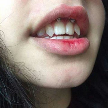 Piercing Smiley