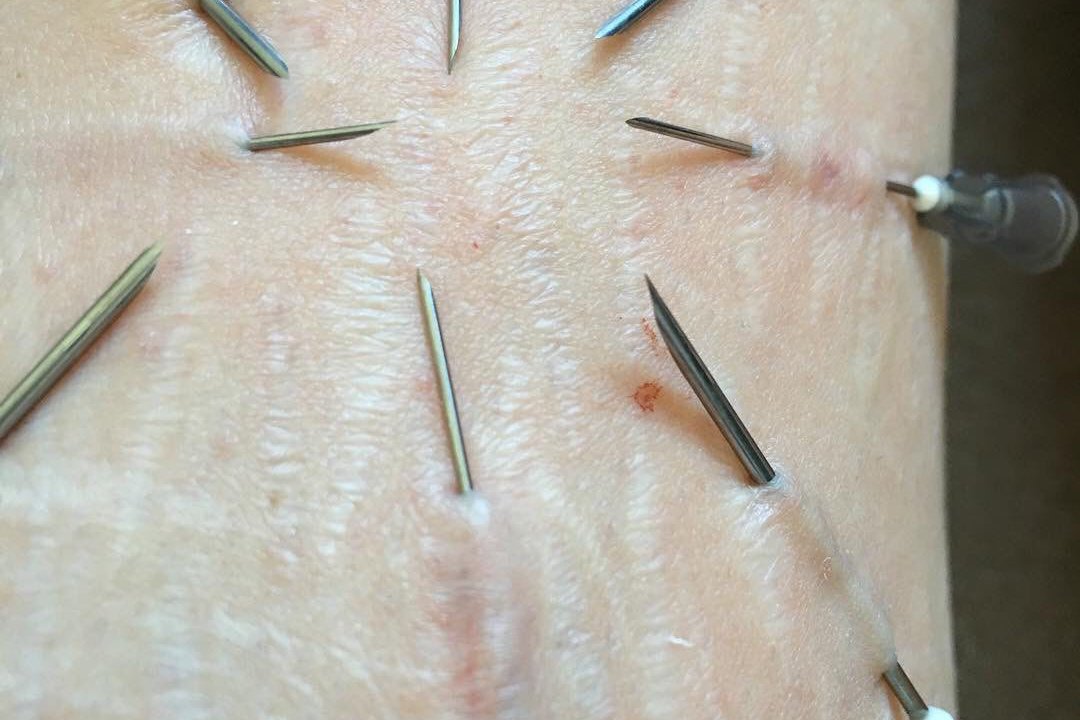 Play Piercing