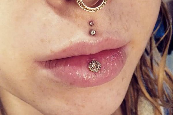 medusa piercing heilungsdauer